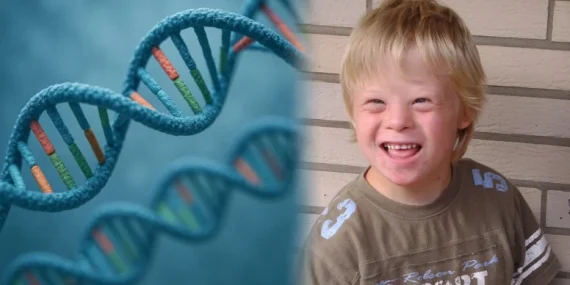 Japon Bilim İnsanları Down Sendromuna Neden Olan Fazla Kromozomu Silmeyi Başardı